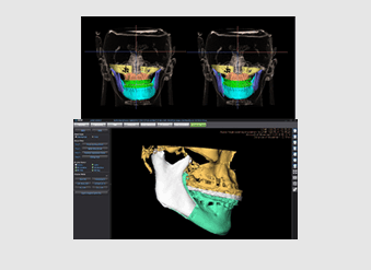 ON3D