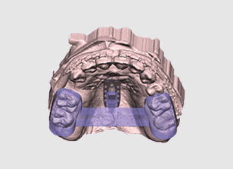 ON3D