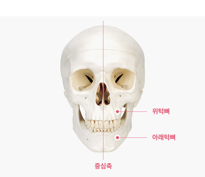 비대칭이란?