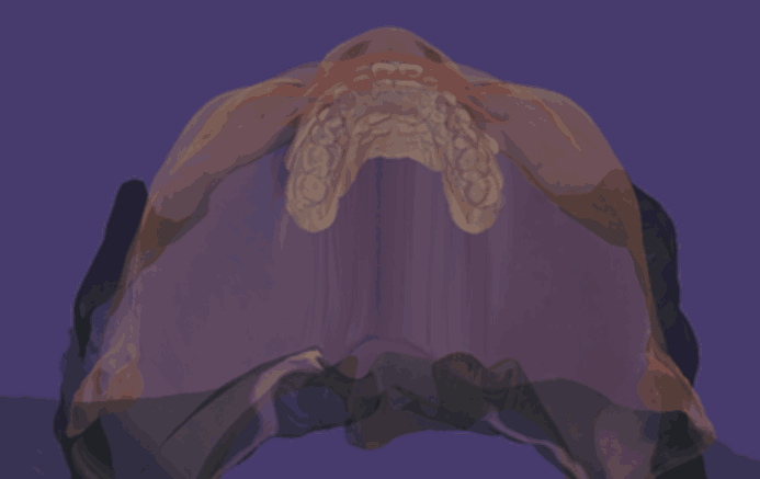 3D CT