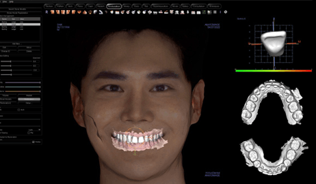 3D얼굴 스캐너