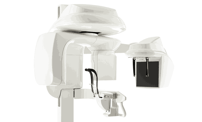 X-ray 충치 진단