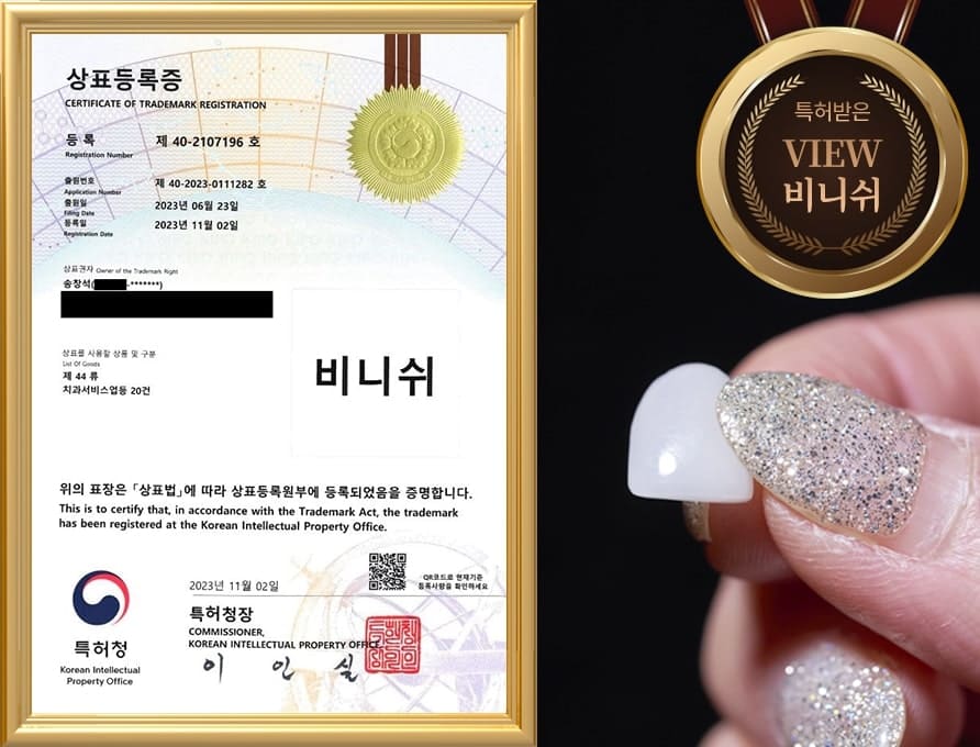 최소삭제 치아성형