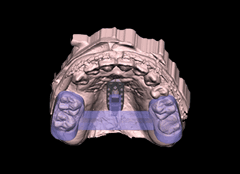 ON3D