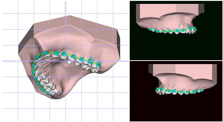 3D스캐너