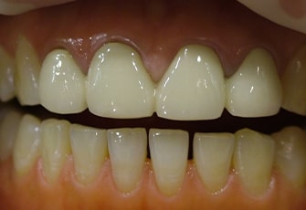 case01_step01