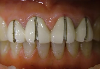 case01_step02