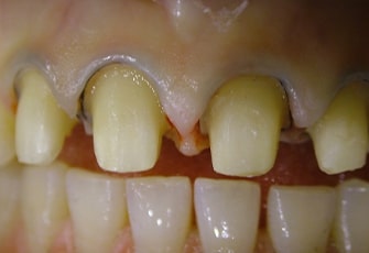 case01_step03