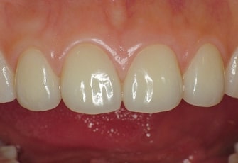 case01_step04